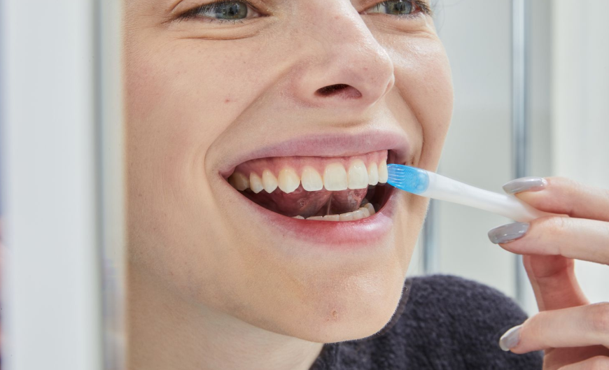 Is Teeth Whitening Safe?
